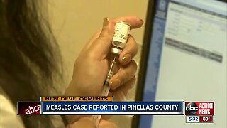 Measles case confirmed in Pinellas County