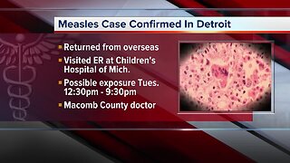 Measles case confirmed in Detroit
