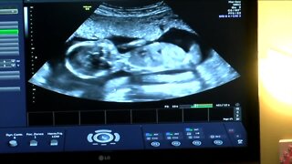 Frustration over ultrasound restrictions