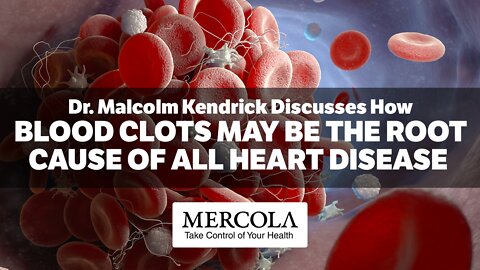 Blood Clots May Be the Root Cause of All Heart Disease- Interview with Dr. Malcolm Kendrick and Dr. Mercola