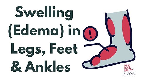Reduce Swelling in the Legs, Feet and Ankles