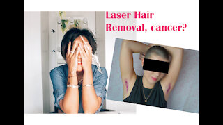 Laser Hair Removal, cancer?!!?!