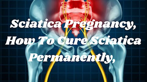 Sciatica Pregnancy, How To Cure Sciatica Permanently, #1