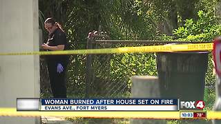 Woman burned in Fort Myers home