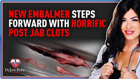LIVE: New Embalmer Steps Forward With Horrific Post Jab Clots