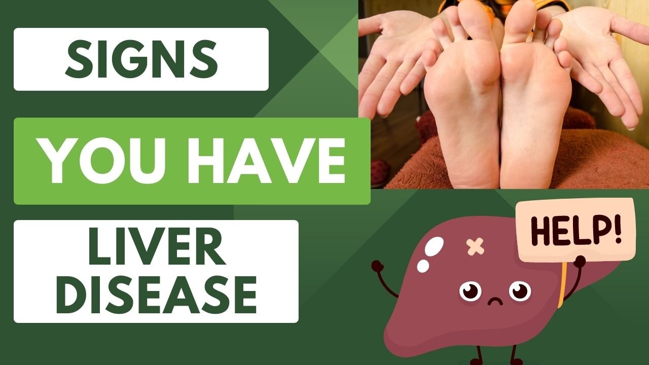 your-hands-and-feet-speak-louder-than-words-understanding-liver