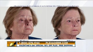 Get Rid of Crow’s Feet and Fine Lines with Plexaderm Skincare