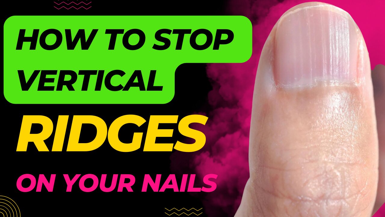 do-you-have-vertical-ridges-on-your-nails-cause