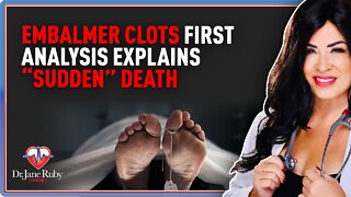 Embalmer Clots First Analysis Explains “Sudden” Death
