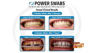 Enhance Your Health And Confidence With Whiter Teeth!