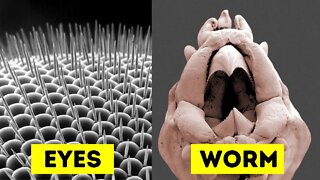 Objects Under Electron Microscope [Part 4]