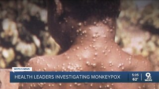 Health leaders try to pinpoint origin of Monkeypox outbreak