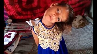 Barn från Pakistan har ett permanent böjt huvud i 180 grader