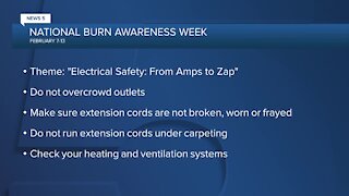 Today marks the start of National Burn Awareness Week