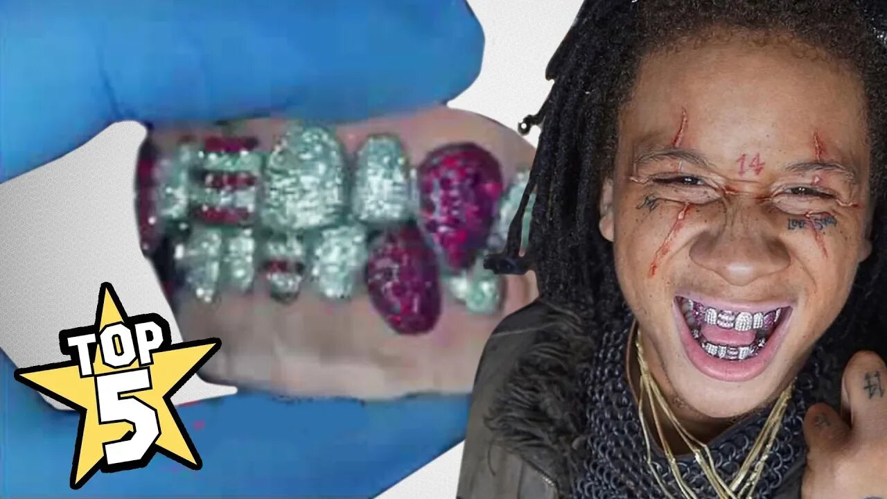 Top 5 Rapper Grillz Part 4 Trippie Redd Moneybagg Yo Smokepurpp