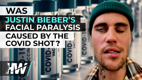 WAS JUSTIN BIEBER’S FACIAL PARALYSIS CAUSED BY THE COVID SHOT?