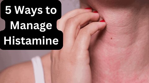 5 Ways to Manage Histamine and The Power of Collagen Peptides