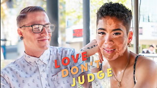 My Blind Date Doesn't Know I Have Vitiligo | LOVE DON'T JUDGE