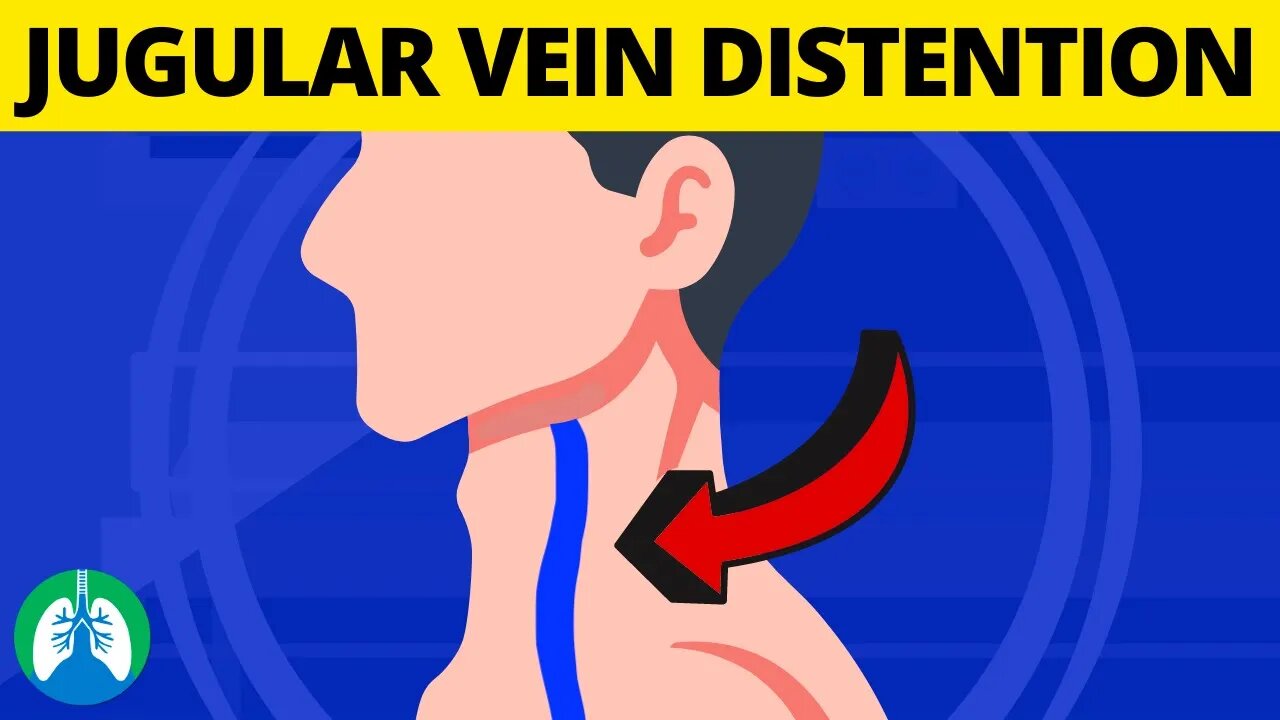 What is Jugular Venous Distention? (Medical Definition and Explanation)