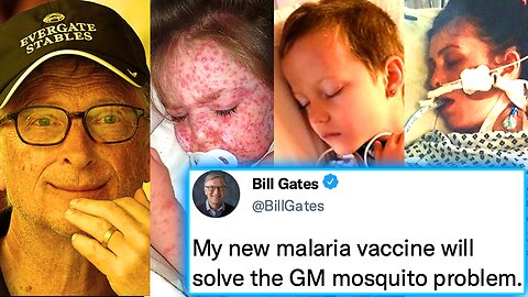 Bill Gates Admits His GM Mosquitoes Are Causing Deadly Malaria Outbreak in U.S.