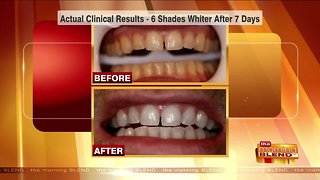 Boost Your Confidence with a Whiter Smile