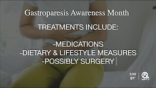 Gastroparesis affects about 5 million people in U.S.