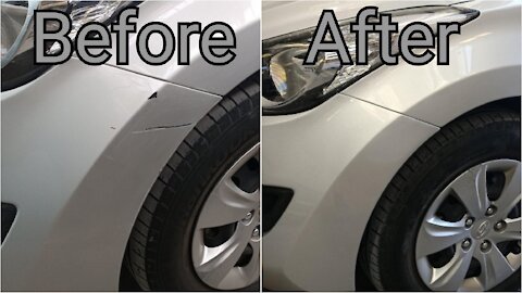 Hyundai Elantra Spot Repair
