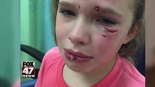 Family wants answers after alleged dog attack