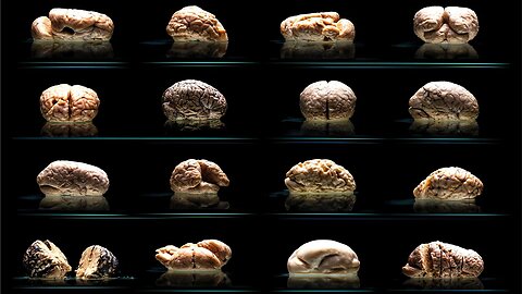 The World's Largest Collection of Human Brains