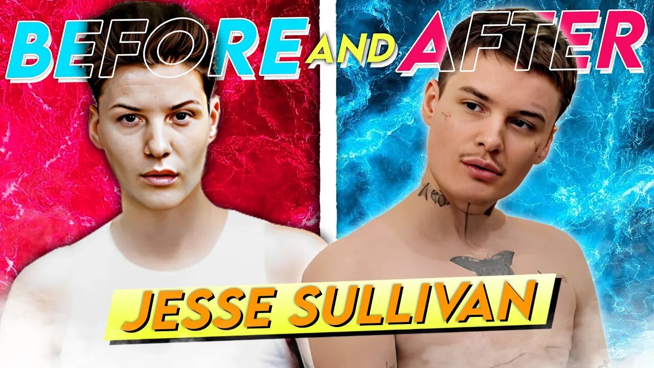 Jesse Sullivan Before And After His Full Transformation 2935