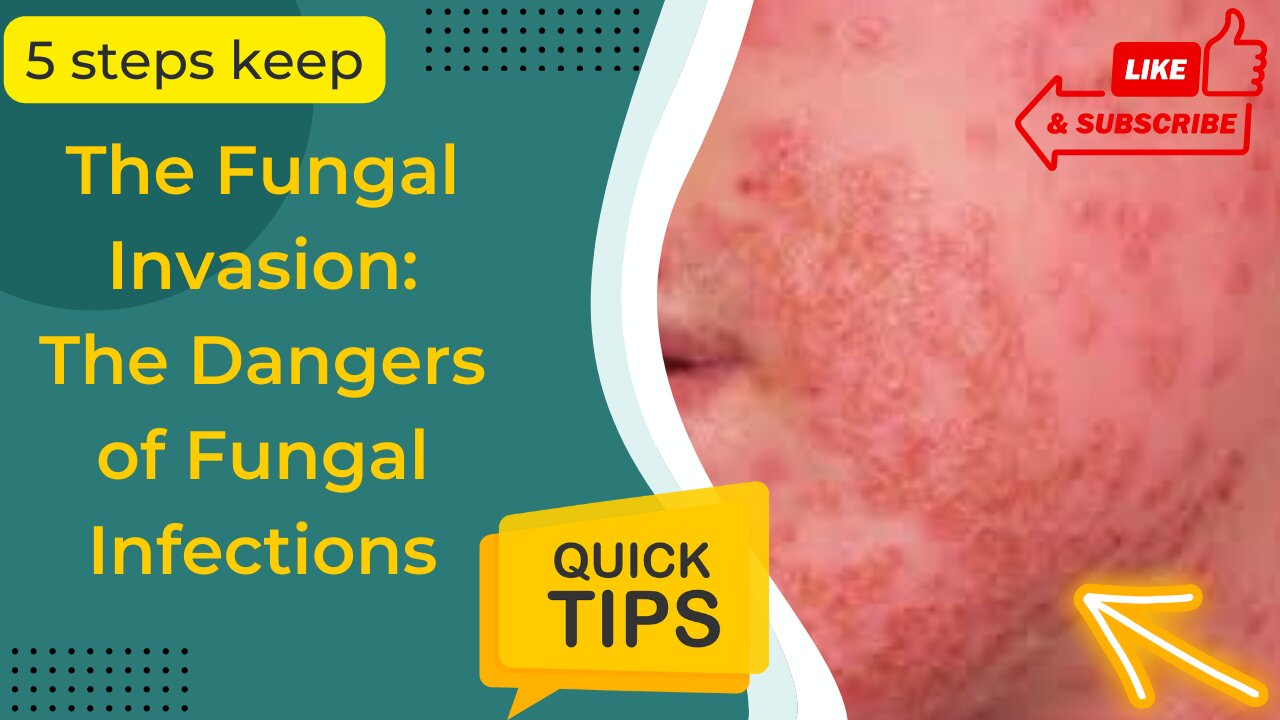 Fungal Infections Unveiled Your Guide To Prevention And Treatment