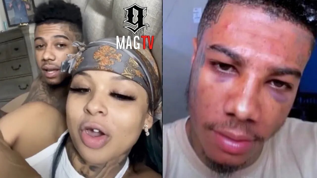 Blueface And Chrisean Rock Explain How His Face Got Blue 🤕