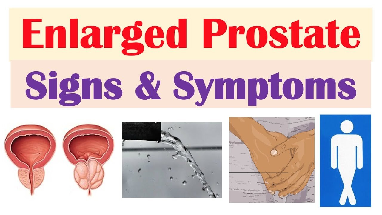 Enlarged Prostate Signs And Symptoms And Why They Occur 0173