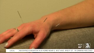 Omaha acupuncture business booming despite pandemic