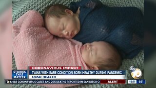 Twins with rare condition born healthy during pandemic