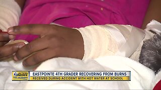 Eastpointe fourth grader recovering from burns after accident at school