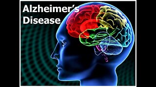 Patriot Health Report 09-16-23 A Cure for Alzheimer's Found!