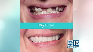 My Dental Dentistry and Implants is giving teachers a FREE Smile Makeover