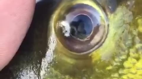 contaminated fish, eyeworms