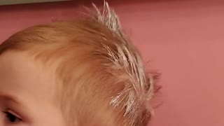 Toddler Unknowingly Puts Rash Cream In Hair
