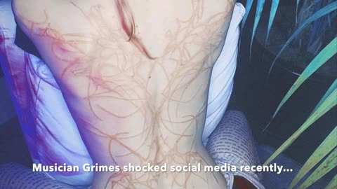 Elon Musk’s girlfriend shares image of her new tattoo, calls it “beautiful alien scars”