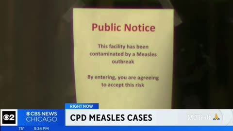 Chicago Police Department Buildings suffer an outbreak of Measles