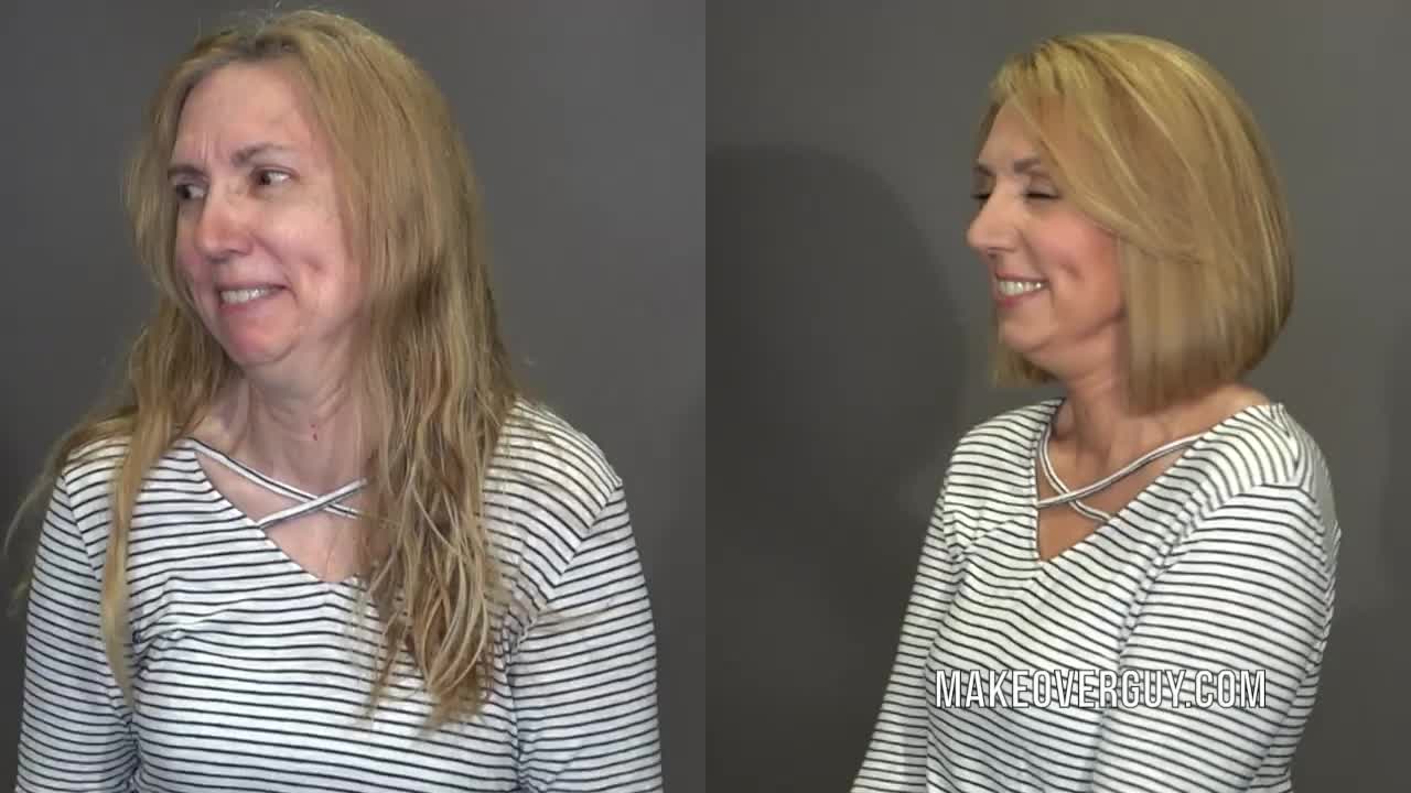 Before and After Archives - Facial Flex