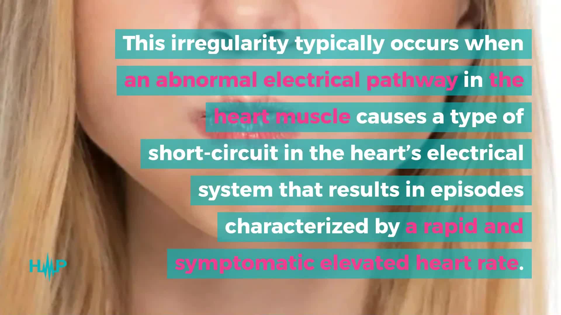 how-to-treat-paroxysmal-supraventricular-tachycardia