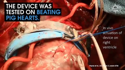 This Device Could Keep Failing Hearts Beating