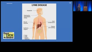 Good lecture on connection between LYME and Mental Health Issues