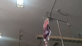 BLOOD TRANSPLANT IN HOSPITAL