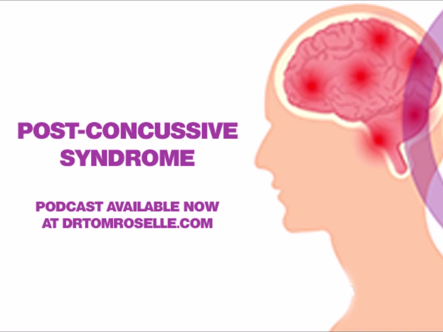 post-concussive-syndrome