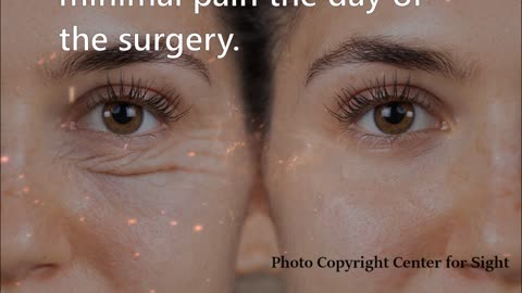 Is Blepharoplasty Right for You?