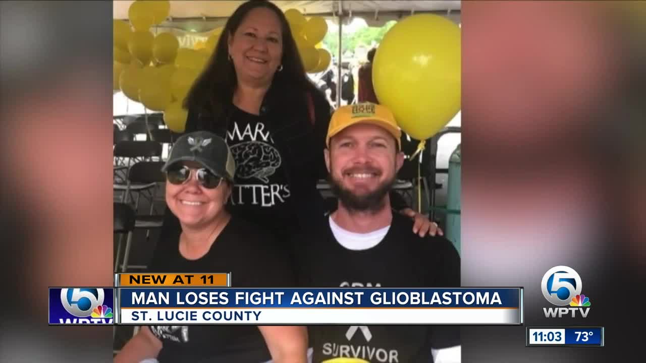 Man loses fight against glioblastoma